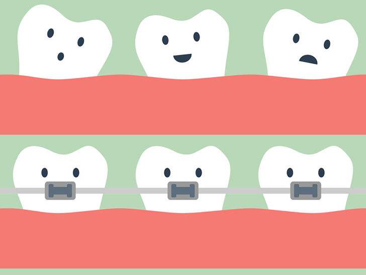 Orthodontic Treatments, colombo, wellawatta